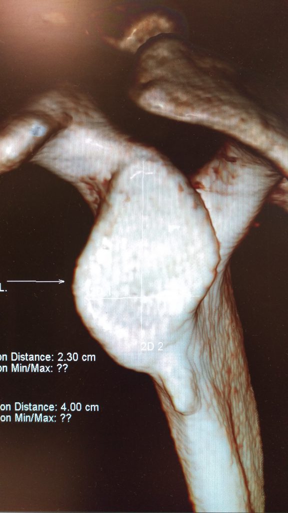 Изображение - Презентация артроскопии плечевого сустава IMAG0165-576x1024