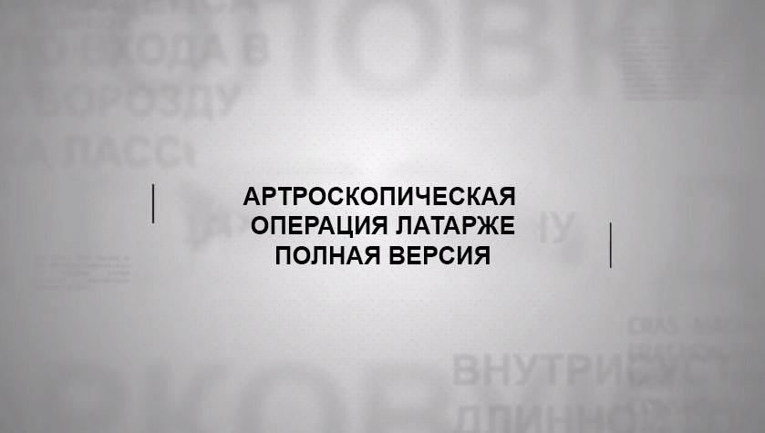 Артроскопическая операция Латарже (полная версия) Артроскопическая операция Латарже (полная версия)